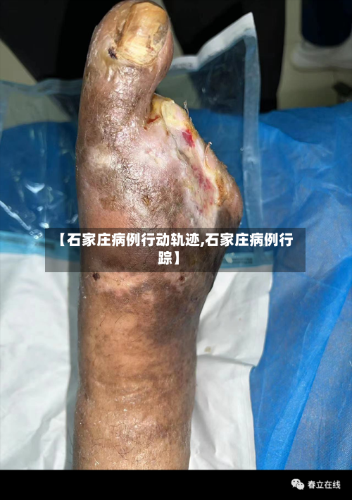 【石家庄病例行动轨迹,石家庄病例行踪】