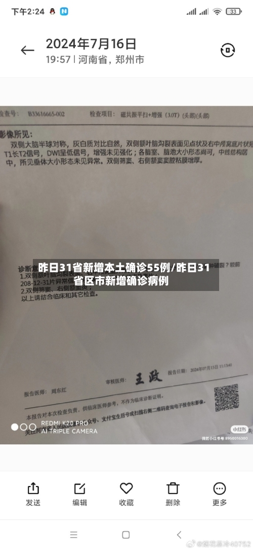 昨日31省新增本土确诊55例/昨日31省区市新增确诊病例