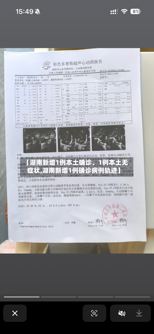 【湖南新增1例本土确诊、1例本土无症状,湖南新增1例确诊病例轨迹】