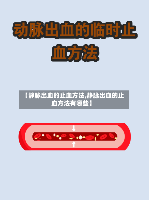 【静脉出血的止血方法,静脉出血的止血方法有哪些】