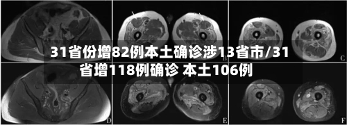 31省份增82例本土确诊涉13省市/31省增118例确诊 本土106例-第2张图片