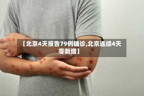 【北京4天报告79例确诊,北京连续4天零新增】